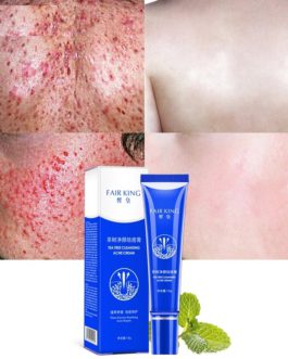 1pcs Tea Tree Cleansing Acne Cream Face Anti Acne Marks Rough Pores Deep Cleansing Control Oil Facial Skin Care Cream 15g
