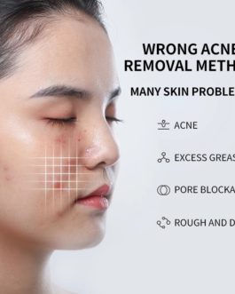 Effective Acne Removal Cream Acne Treatment Anti-acne Repair Fade Acne Spots Oil Control Whitening Face Skin Gel Care 20g